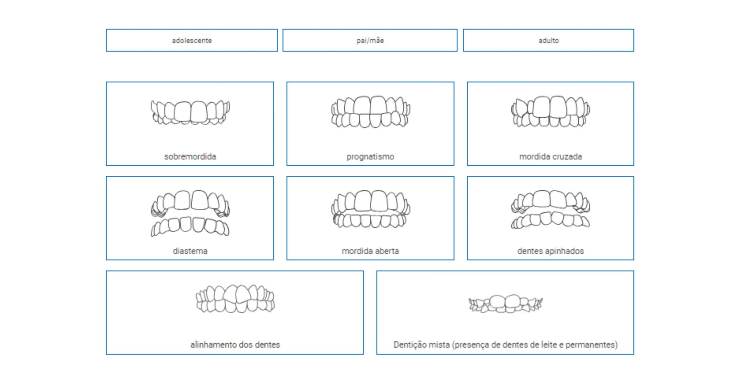invisalign-tipos
